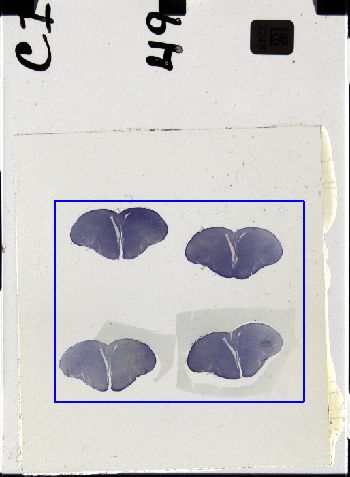 Media type: image; Special Collections 3298   shows specimen_part histological serial section;
